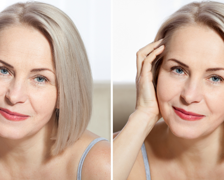 The Art of Aging Gracefully: Your Guide to Timeless Beauty